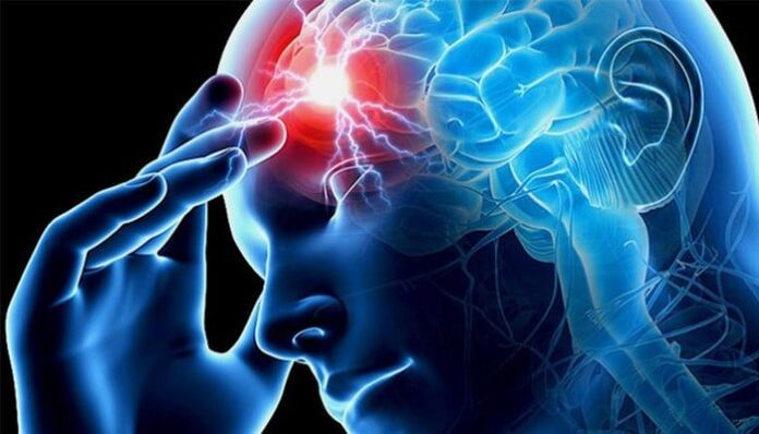 Proteina Spike dei Vaccini mRNA: Presenza Prolungata nelle Arterie Cerebrali e Rischio di Ictus